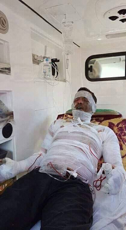 جندوبة : شاب يضرم النار في جسده وحالة احتقان امام البلدية (صور)